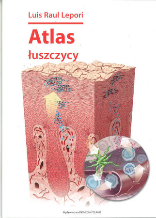 Atlas łuszczycy