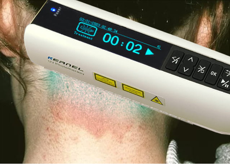 Zakup lampy do fototerapii w warunkach domowych Kernel UVB 311nm KN-4003BL2D (bezprzewodowa)